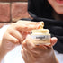 acne-scar-cream